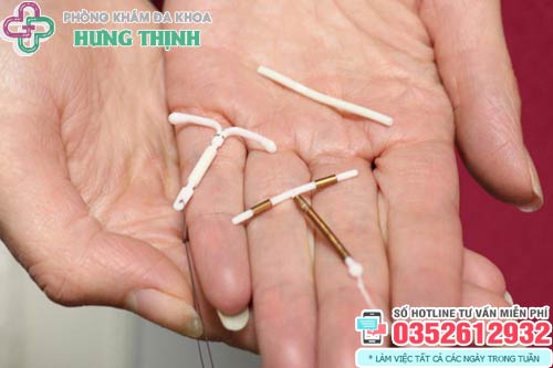 Tháo vòng tránh thai tốn bao nhiêu tiền?