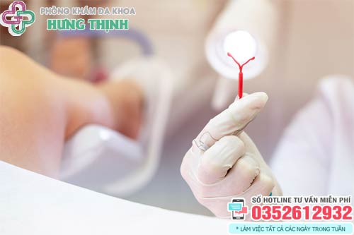 Đặt vòng tránh thai có tác dụng phụ gì không?