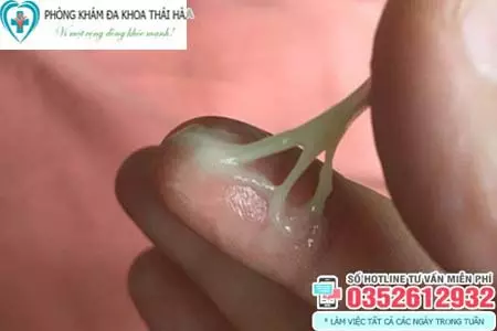 Khí hư màu xanh như nước mũi