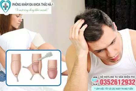 Cắt bao quy đầu có làm giảm khoái cảm