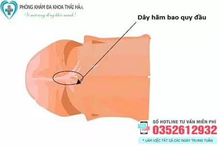 Cắt dây hãm bao quy đầu giá bao nhiêu?