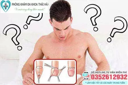 Cắt bao quy đầu bao lâu thì khỏi hẳn