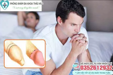 Cắt bao quy đầu bao lâu thì lành vết thương