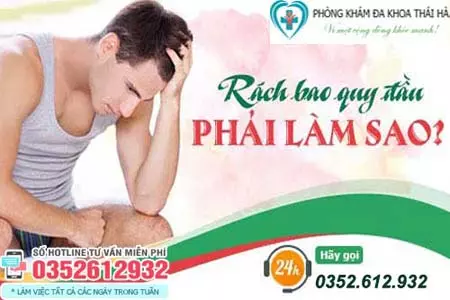 Bị rách bao quy đầu phải làm sao?