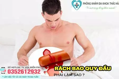 Cách chữa rách bao quy đầu tại nhà