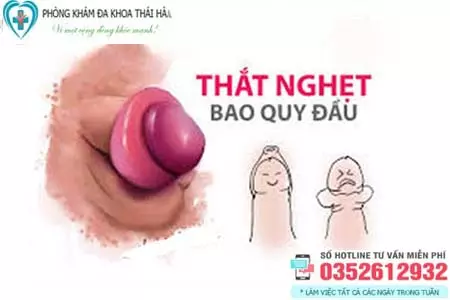 Cách chữa nghẹt bao quy đầu tại nhà