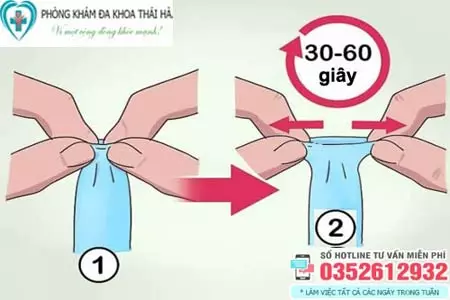 Cách lột bao quy đầu tại nhà
