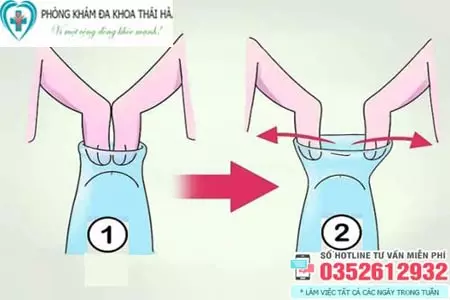 Cách lột bao quy đầu bị hẹp