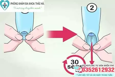Cách lột bao quy đầu dài tại nhà