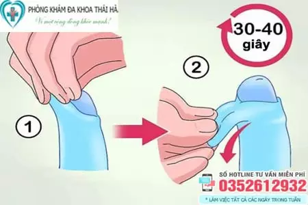 Cách lột bao quy đầu cho trẻ