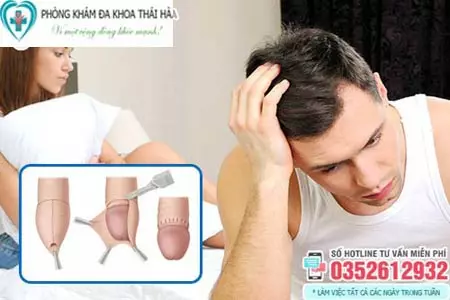 Cách chữa hẹp bao quy đầu