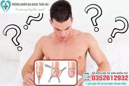 Không cắt bao quy đầu có sao không?