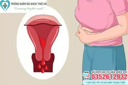 Sau hút thai ra máu bao lâu