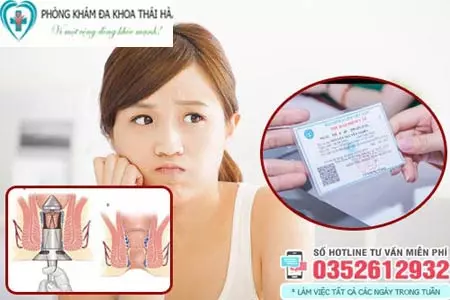 Cắt trĩ có được hưởng bảo hiểm y tế không