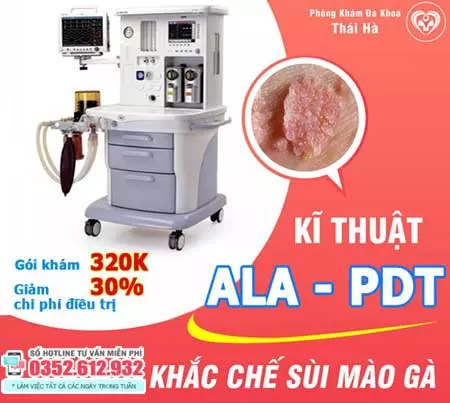 Chữa sùi mào gà bằng ALA-PDT