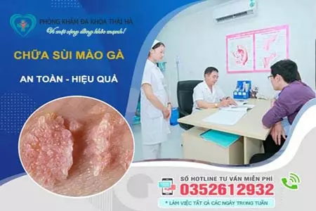 Chữa sùi mào gà Phòng khám Thái Hà
