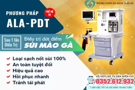 Chữa sùi mào gà hiệu quả