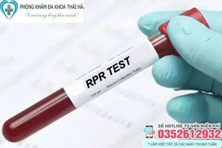 Xét nghiệm RPR là gì