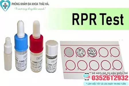 Xét nghiệm RPR giang mai