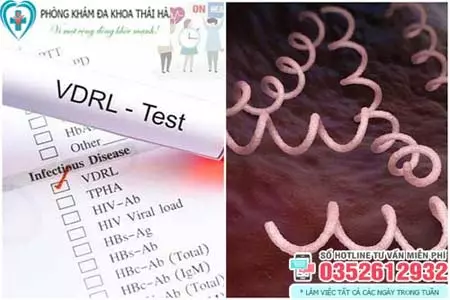 Xét nghiệm giang mai sau bao lâu thì chính xác