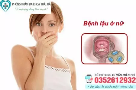 Bệnh lậu ở nữ giới