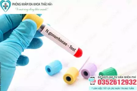Xét nghiệm bệnh lậu bằng cách nào