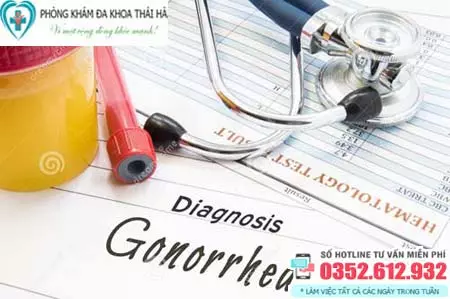 Chi phí xét nghiệm bệnh lậu hết bao nhiêu tiền