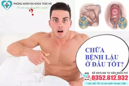 Chữa bệnh lậu ở đâu tốt