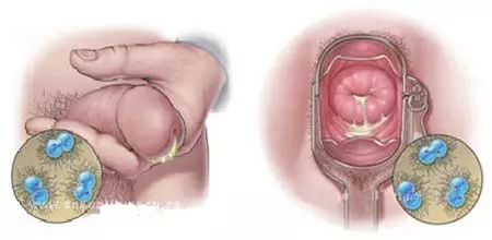 Giá tiền chữa bệnh lậu