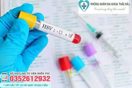 Xét nghiệm HSV ở đâu