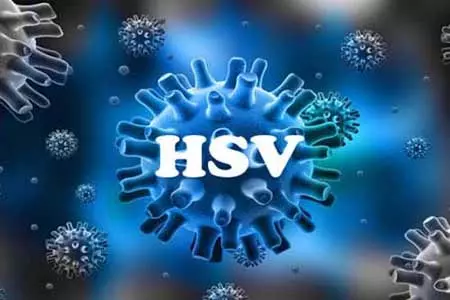 Virus HSV là gì