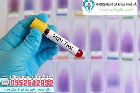 Xét nghiệm HSV bao nhiêu tiền