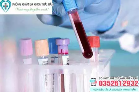 Xét nghiệm bệnh xã hội là gì