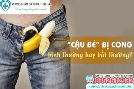 Dương vật cong bên trái có sao không