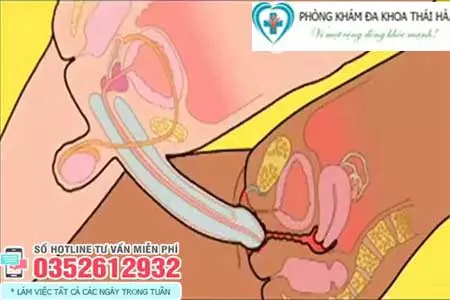 Dương vật dài bao nhiêu thì chạm cổ tử cung