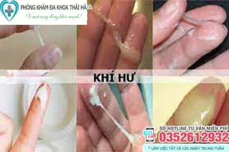 Dấu hiệu khí hư bất thường
