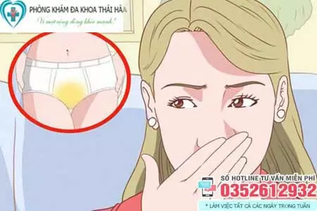 Quần lót có màu vàng là bệnh gì