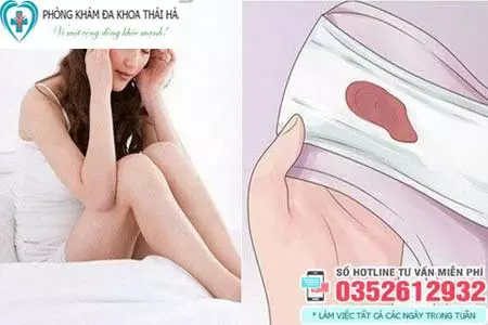 Ra khí hư màu nâu đen trước kỳ kinh nguyệt