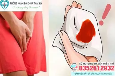 Ra khí hư có lẫn máu là bệnh gì