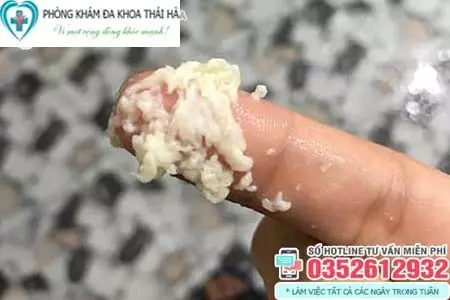 Cách chữa trị khí hư bã đậu