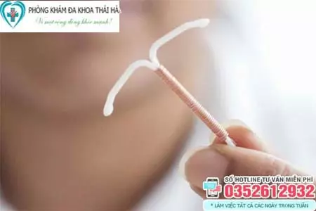Chi phí đặt vòng tránh thai bao nhiêu tiền