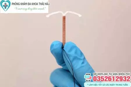 Tác dụng phụ của đặt vòng tránh thai