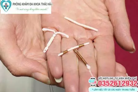 Tháo vòng tránh thai tốn bao nhiêu tiền