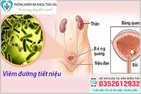Khám viêm đường tiết niệu ở đâu