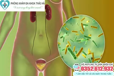 Chi phí khám viêm đường tiết niệu