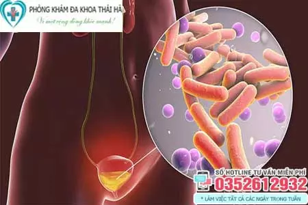 Cách chữa viêm đường tiết niệu