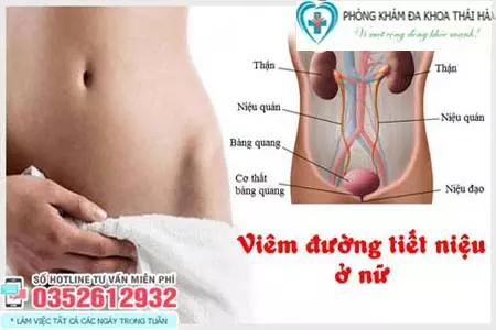 Cách chữa viêm đường tiết niệu ở nữ tại nhà