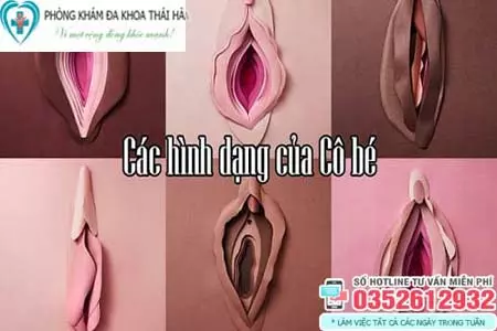 Hình ảnh vùng kín bị thâm