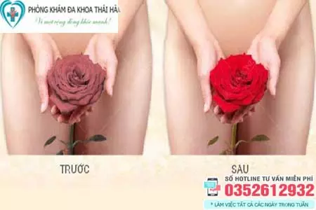 Cách khắc phục vùng kín bị thâm đen