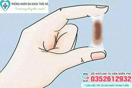 Vùng kín ra dịch màu nâu đen không mùi